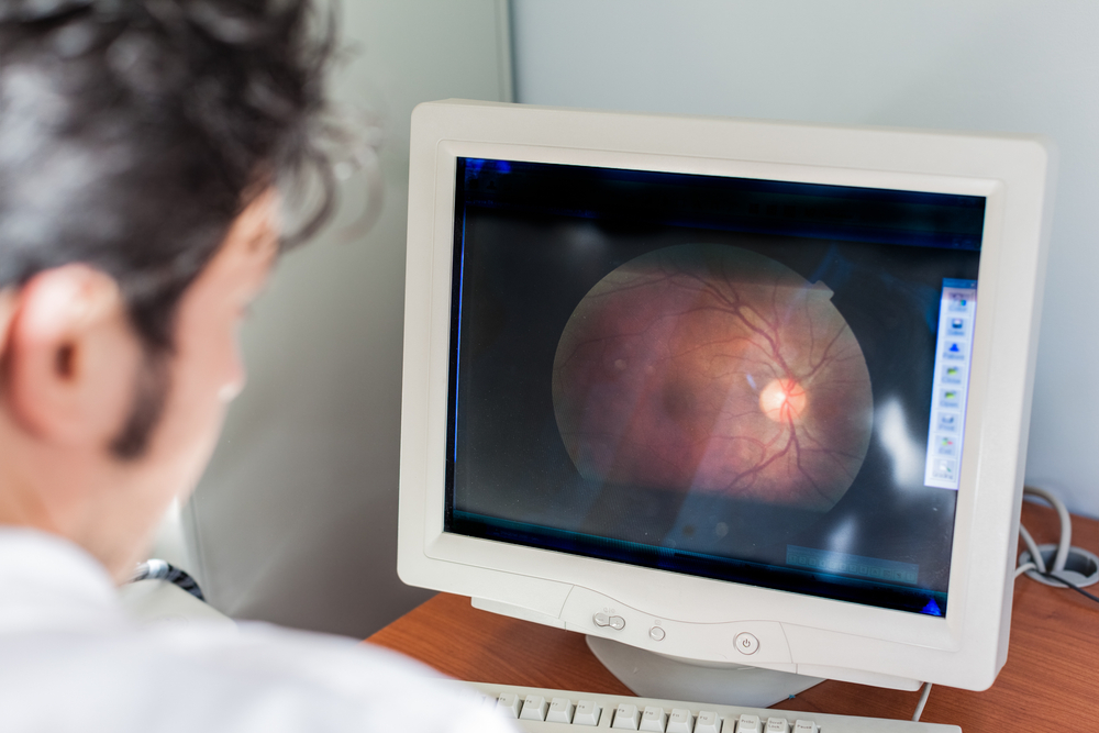 retinal scan of the eye